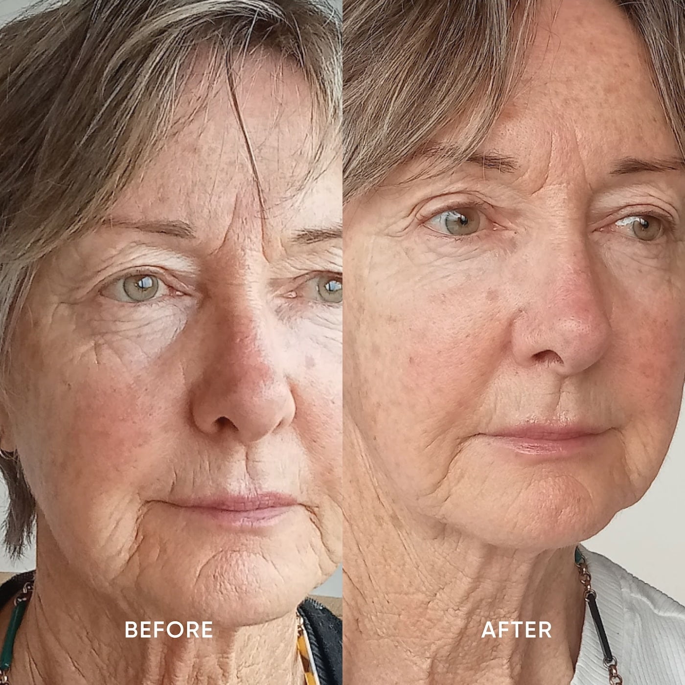 A woman’s skin improves from using Firming Serum before and after photos shown side by side