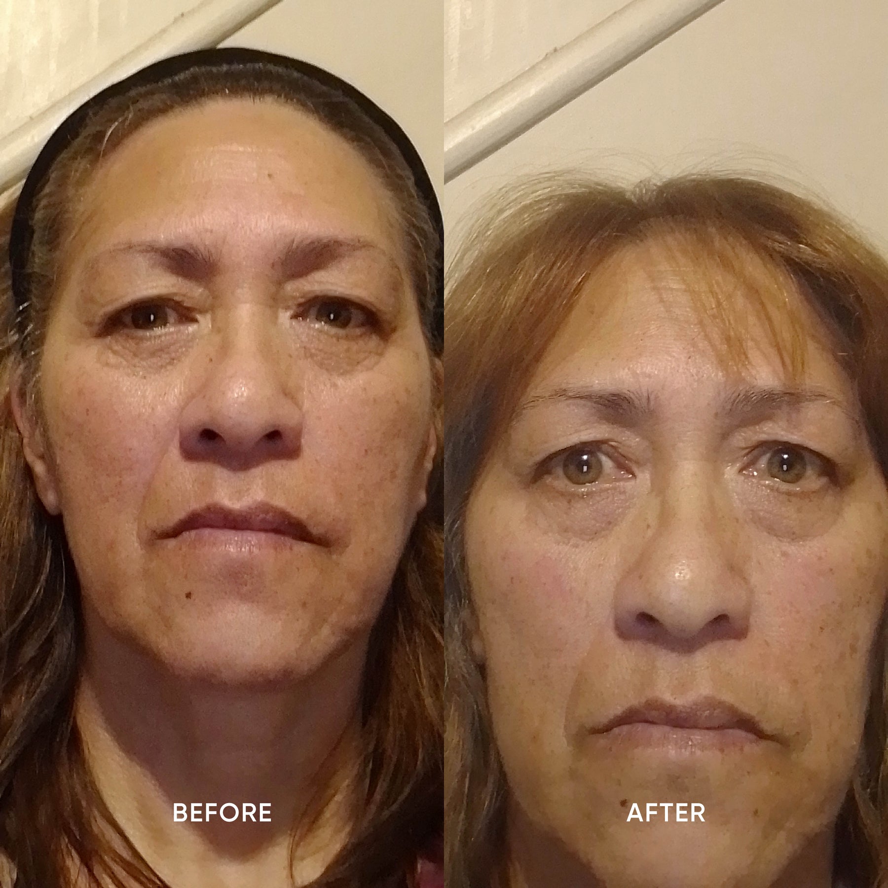 ManukaRx Restorative Eye Cream customer before and after images